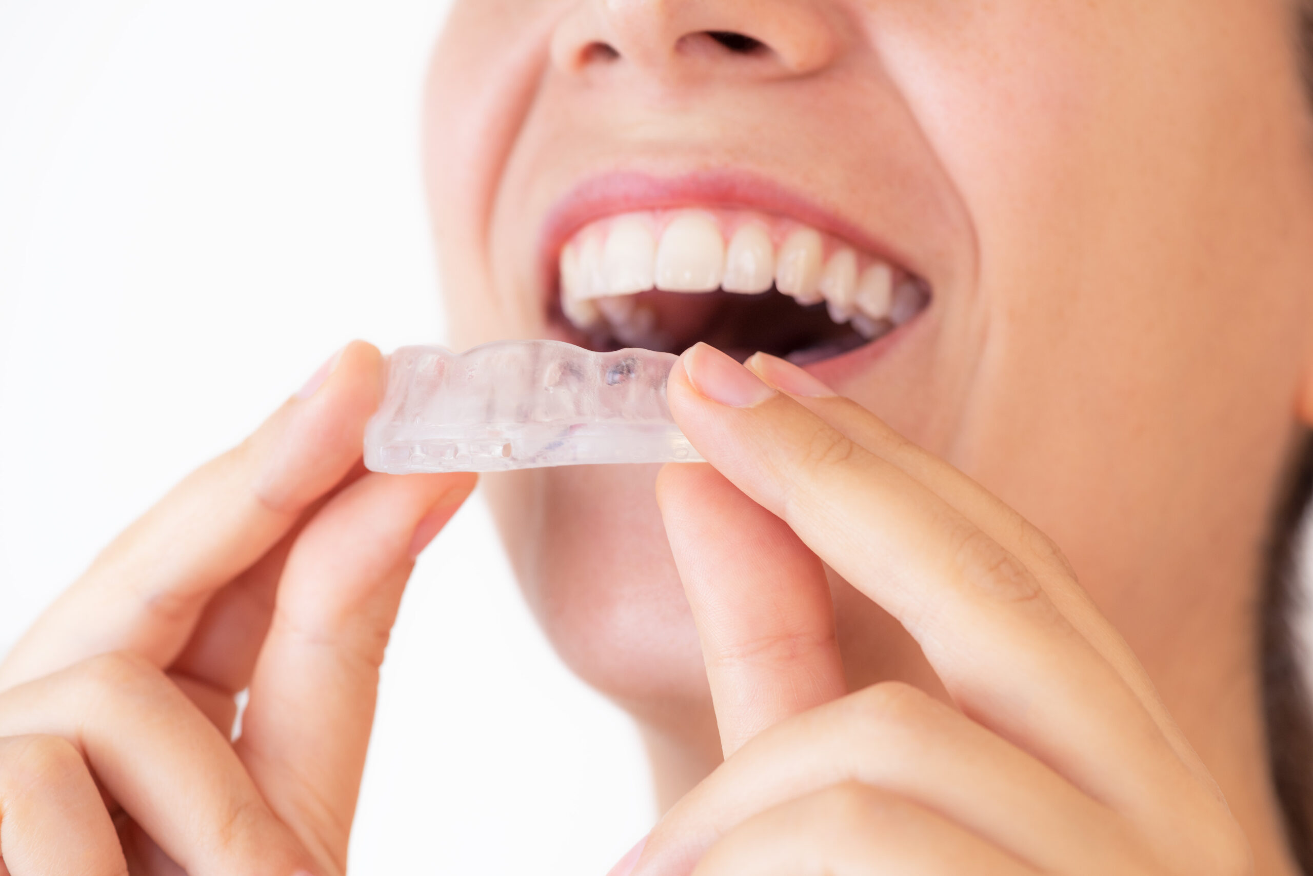 Mouth Guards: Benefits and Types Explained | Oral Health Guru